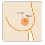 nipple areola complex
